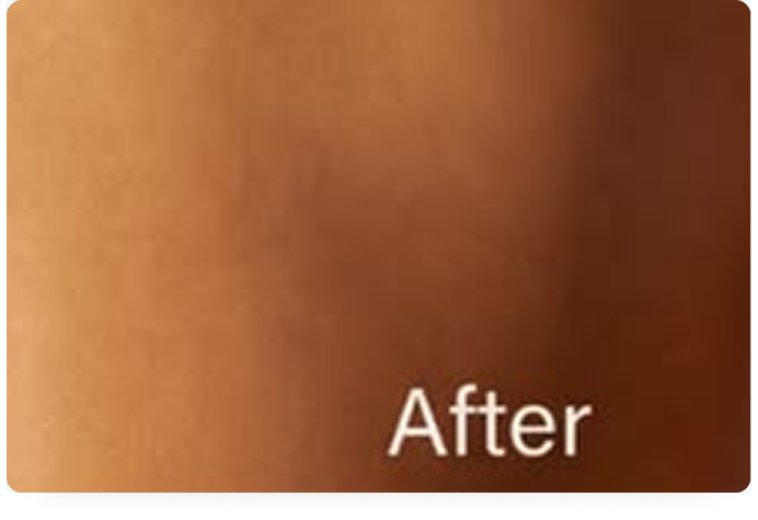 Dopo